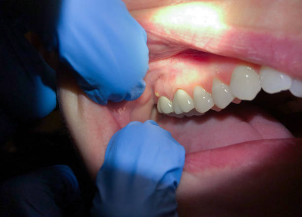 Best Emergency Dental Services for Seniors in Alma, GA