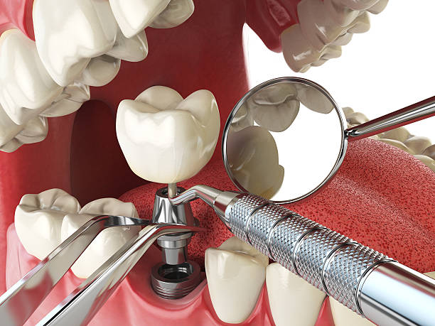 Best Emergency Dental Extractions in Alma, GA